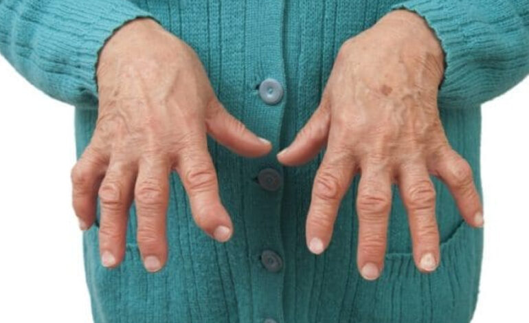 La artritis reumatoide afecta mucho más que las articulaciones: hasta 1 de cada 2 pacientes sufre síntomas depresivos
